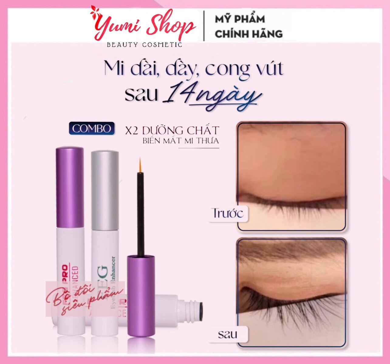 Combo Serum Dưỡng Mi Toàn Diện - Mi Dàidày Cong Vút Sau 14 Ngày