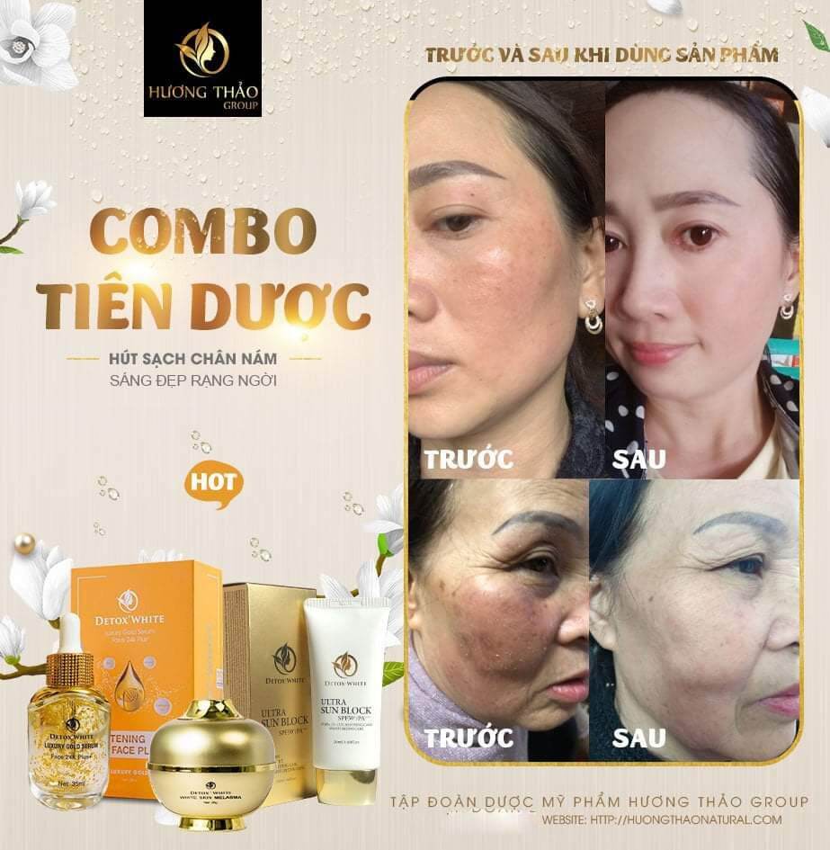 CAO NÁM MELASMA WHITE SKIN DETOX WHITE
