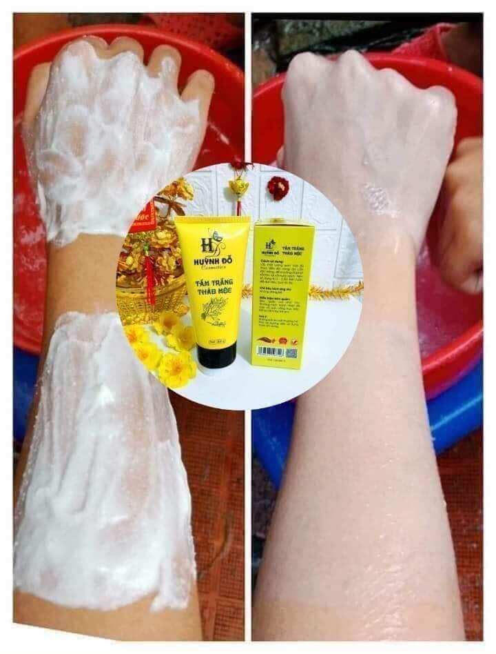 Tắm trắng thảo mộc Huỳnh Đỗ
