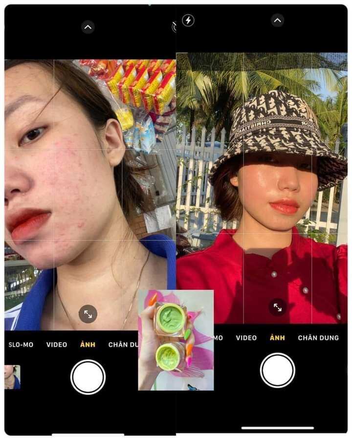 COMBO KEM TRÀ XANH MỤN SERUM BÍCH CAO WHITE