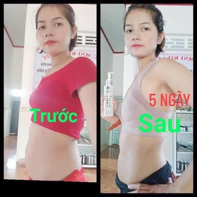 CAO TAN MỠ TRẦN KIM HUYỀN