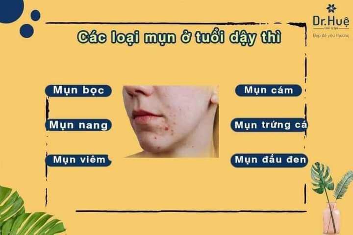 Sữa rửa mặt Diếp Cá IGREEN – sạch sâu, ngừa mụn