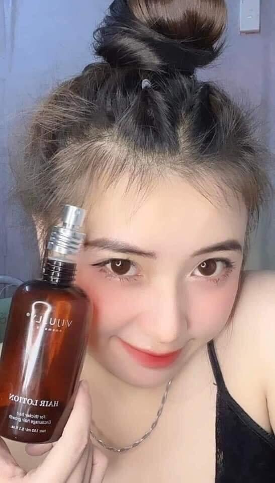 Xịt Mọc Tóc Vijully Kích Thích Tóc Mọc ,Ngăn Rụng Tóc ,150ml