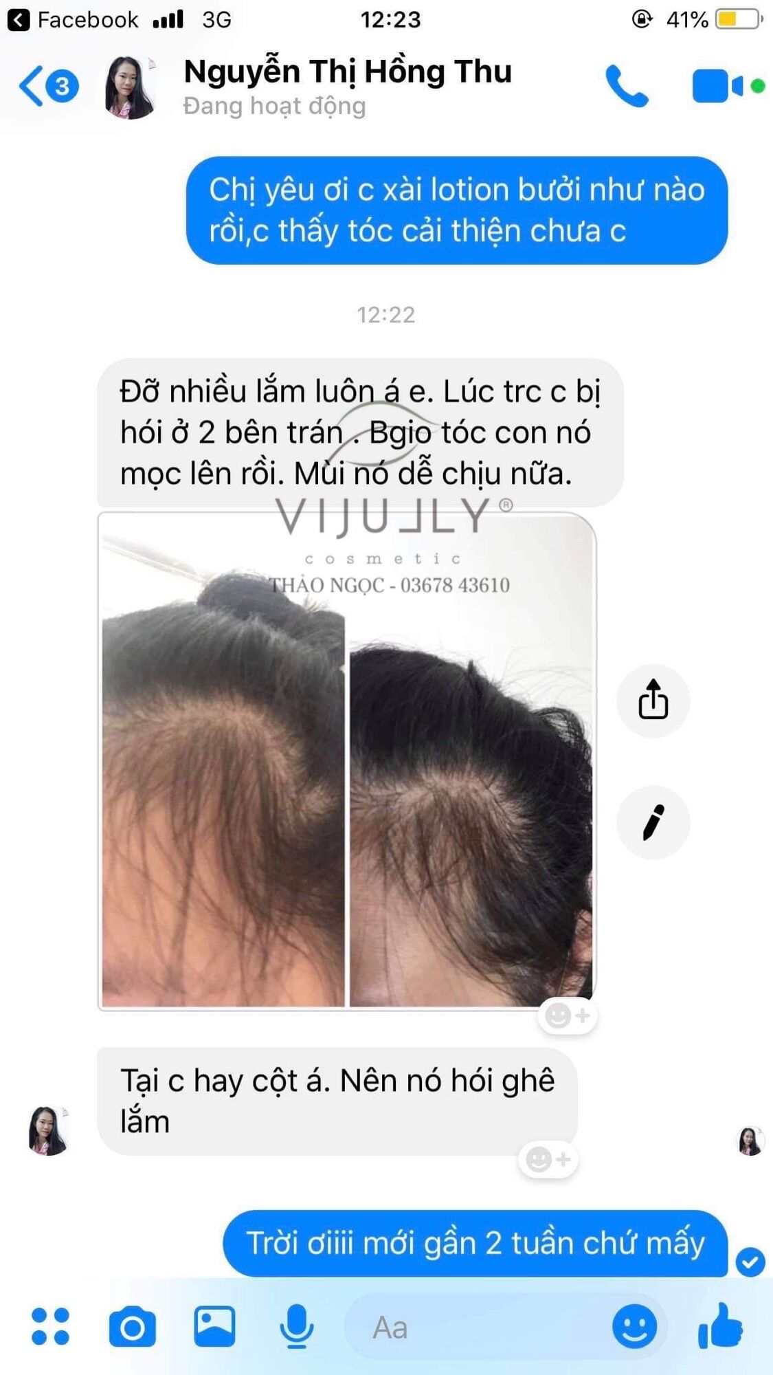 [COMBO GIÁ RẺ] 3 Chai Tinh Dầu Bưởi Vi Jully