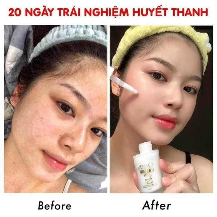 Huyết thanh 7day Queenie skin giúp căng bóng da mịn màng lọ 50,ml