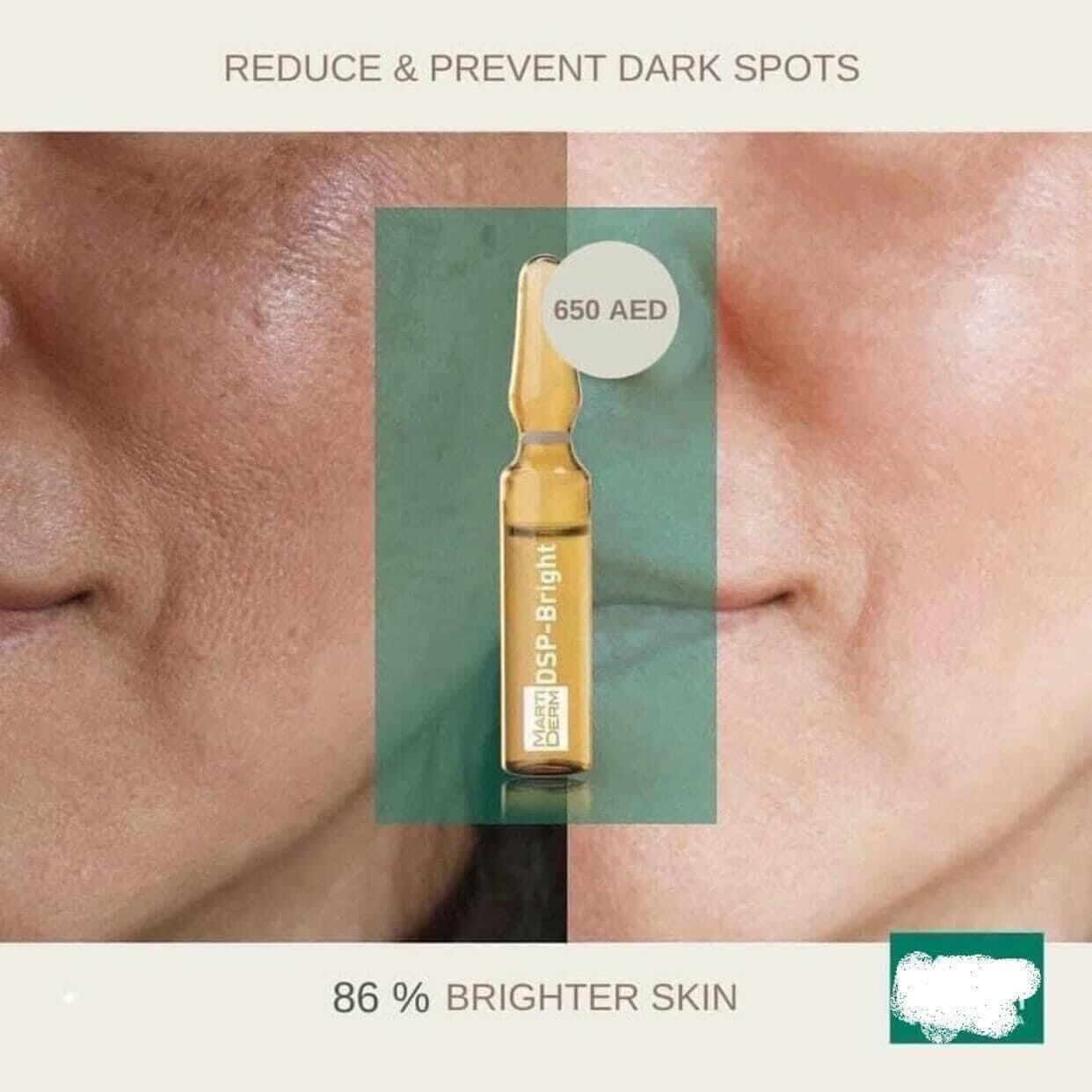 Martiderm Pigzero DSP Bright dưỡng sáng đều màu