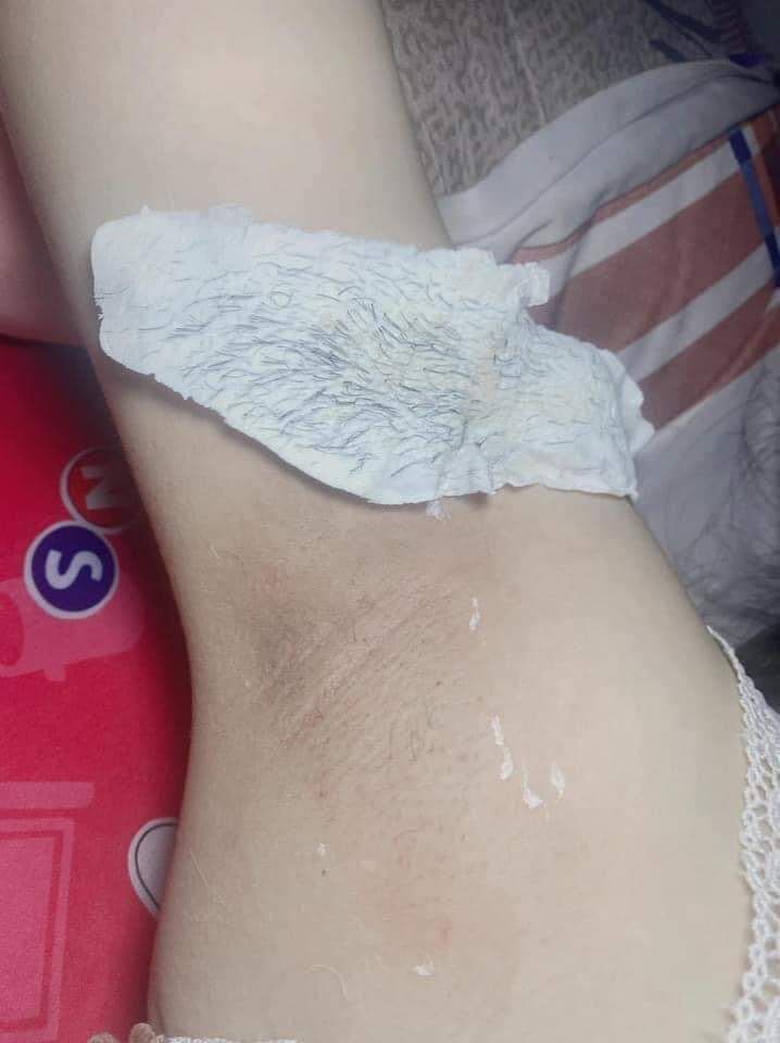 Combo sáp wax triệt lông tại nhà ( có chén )