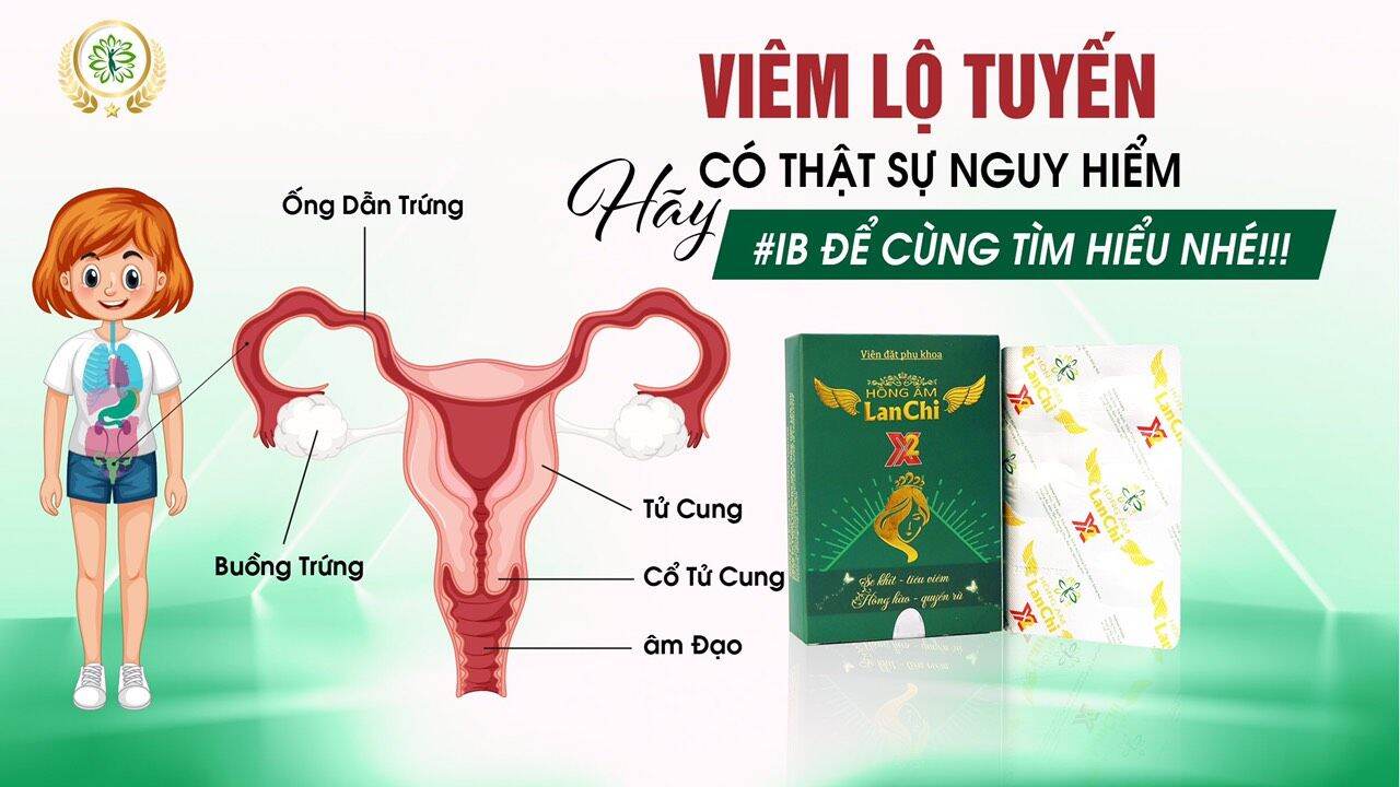 Kén đặt hồng âm x2 lan chi : làm sạch v u ng k i n h chị em, hỗ trợ tất cả các vấ n đề về p hu k h o a, s e. k h it, h ong hào , quy ê n ru