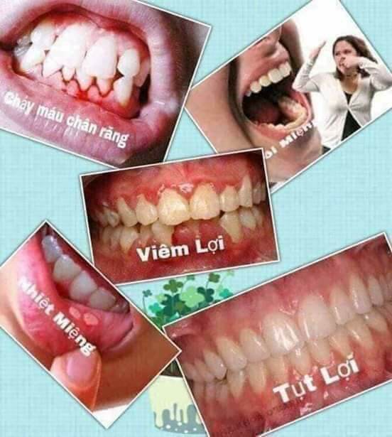 Sản phẩm Răng miệng An Khánh Tâm