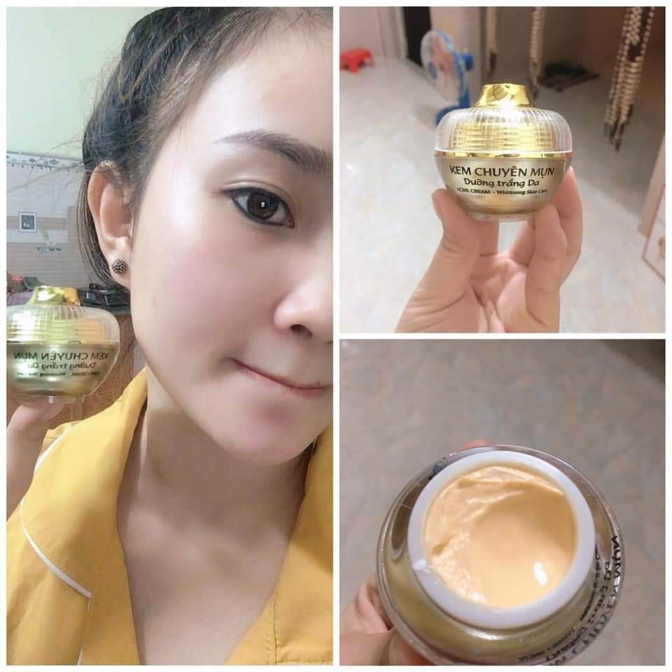 kem face chuyên mụn Huỳnh Đỗ