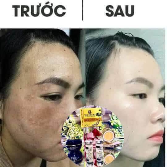 Kem Nám Balla Luta ,
