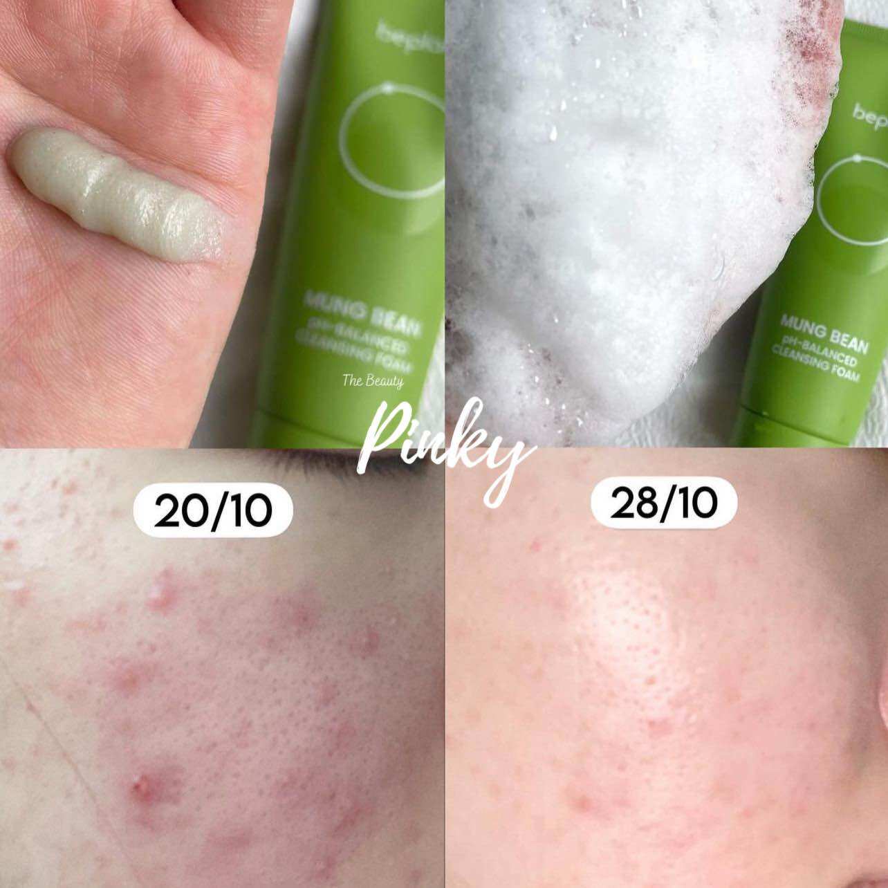 [Chính hãng] Sữa rửa mặt BEPLAIN Mung Bean pH+ Cleansing Foam 80ml