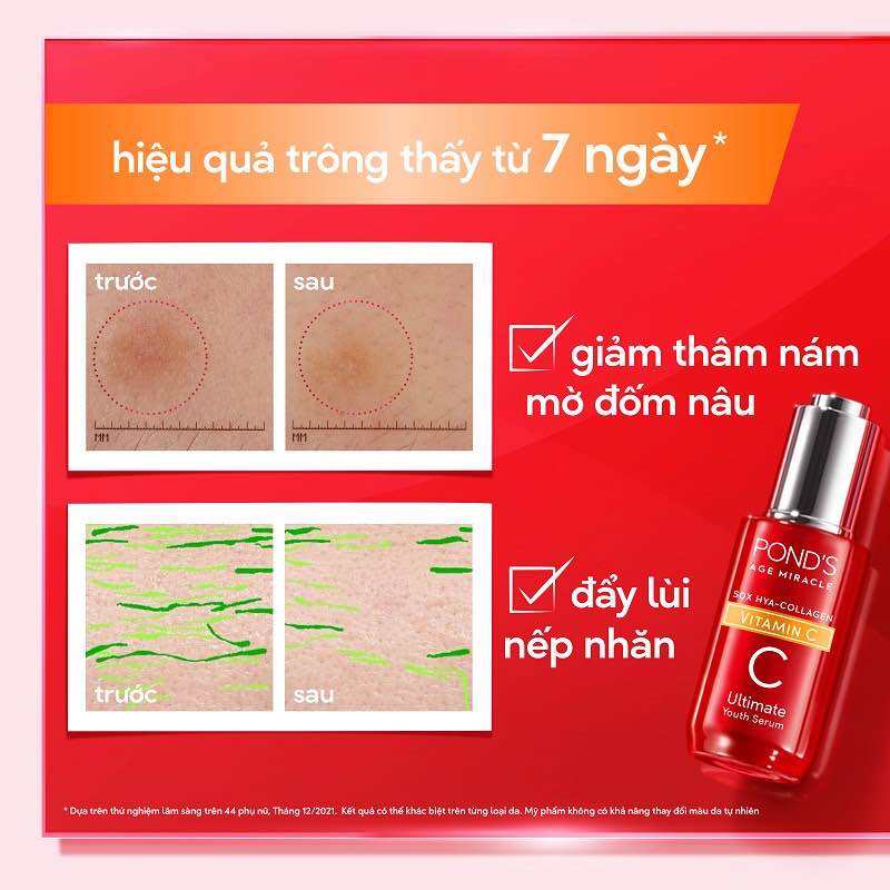 01 Hộp 6 gói Serum Pond’s Vitamin C tinh chất dưỡng sáng mờ đốm nâu POND'S Age Miracle Ultimate Youth Vitamin C HA Collagen - gói serum pond’s đỏ 7g