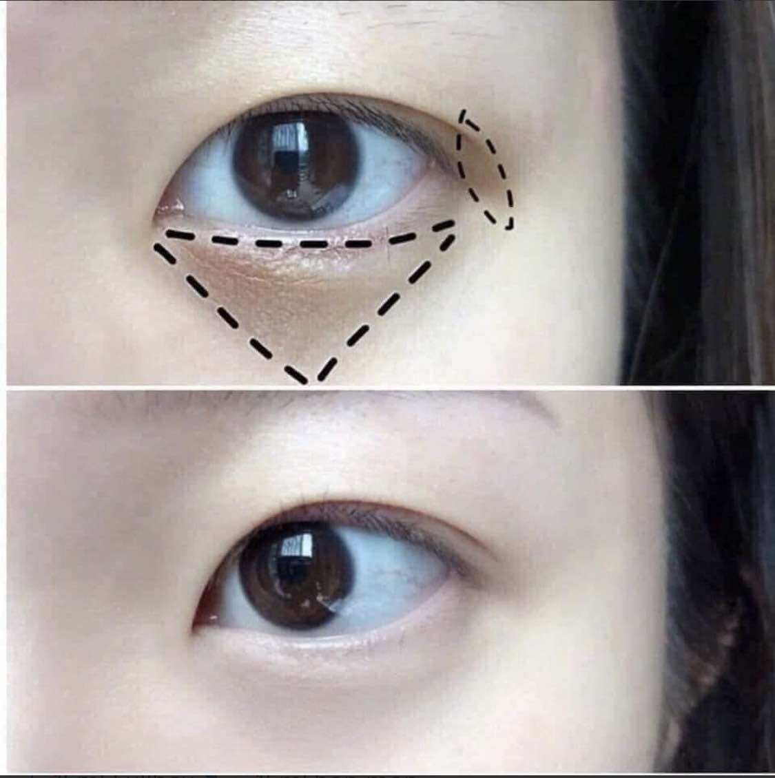 Kem mắt RoC Retinol Correxion Eye Cream 15ml