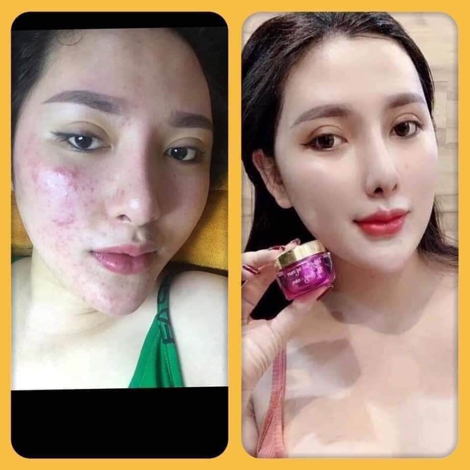 KEM FACE TÍM N COLLAGEN