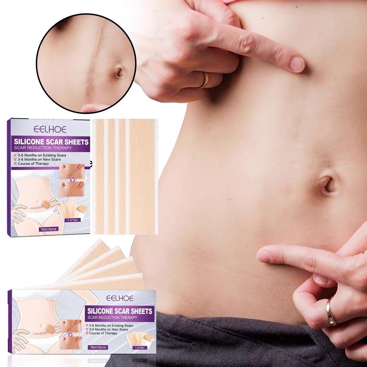 Bộ 4 miếng dán che sẹo lồi sẹo lõm sẹo thâm