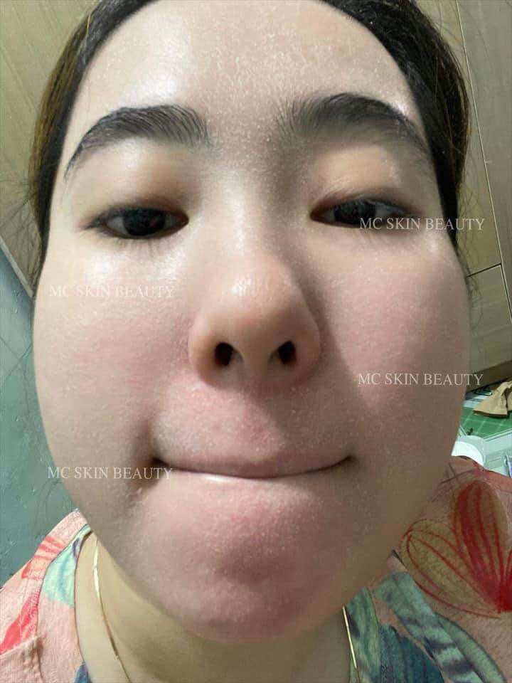COMBO TÁI TẠO HỒNG SÂM MCSKIN