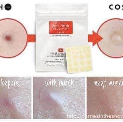 Miếng dán mụn Cosrx Acne Pimple Master Patch bịch 24 miếng (pack of 24pcs)