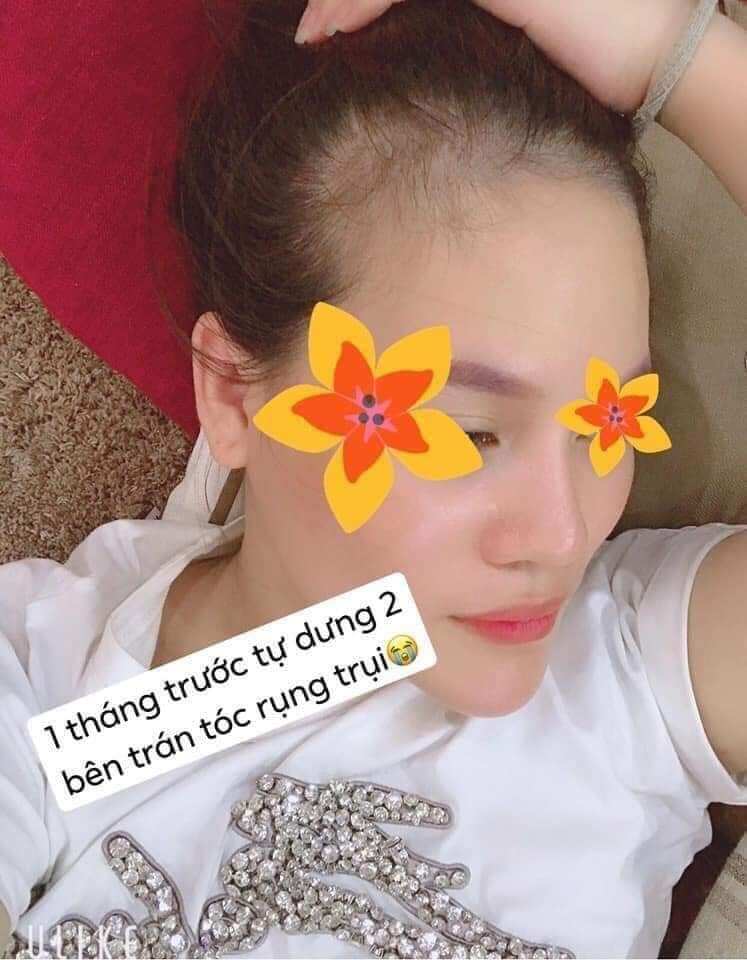 Tinh Dầu Bưởi Xịt Mọc Tóc Thái Lan