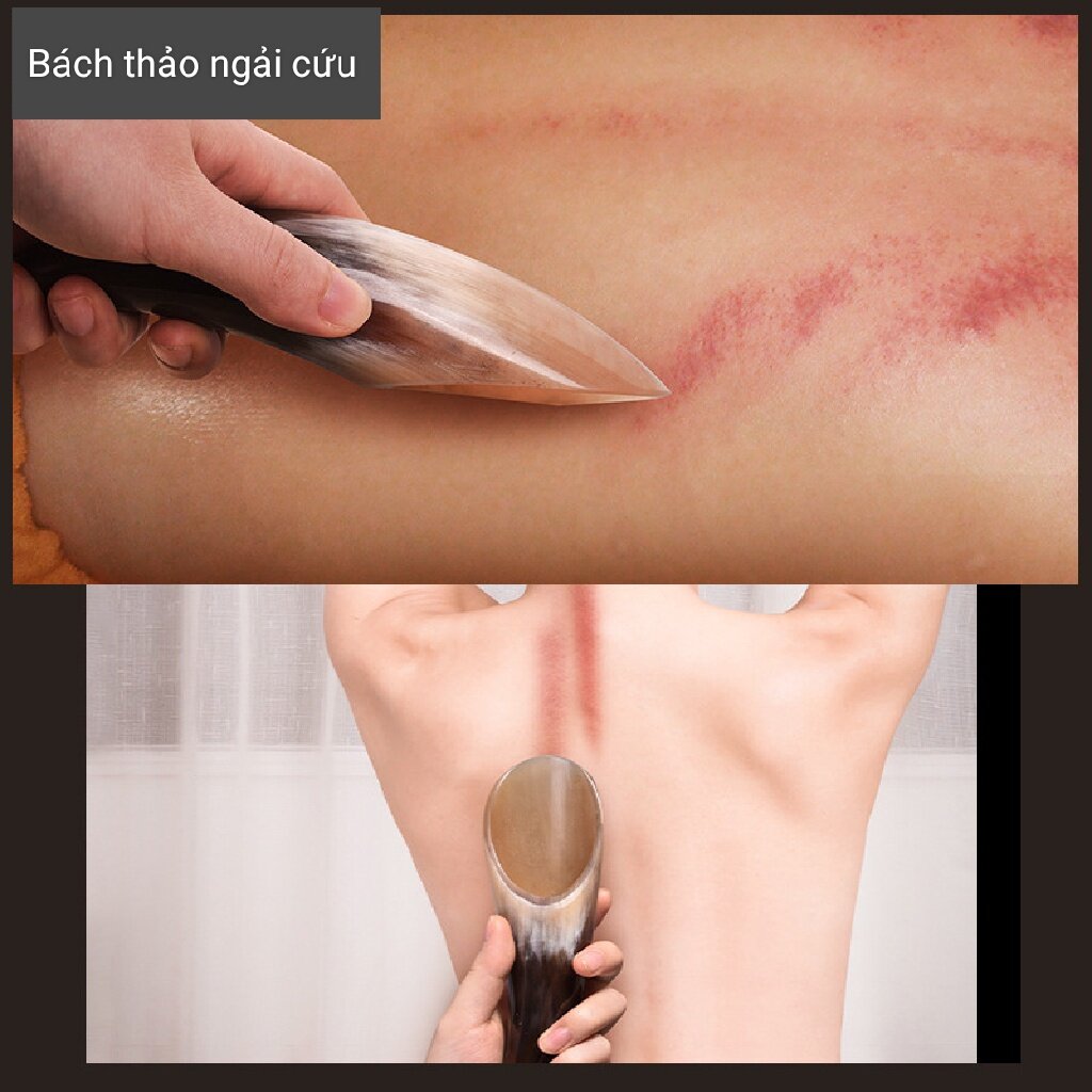 Dụng cụ điện chẩn massage - cây cạo gió, day ấn huyệt bằng sừng tự nhiên
