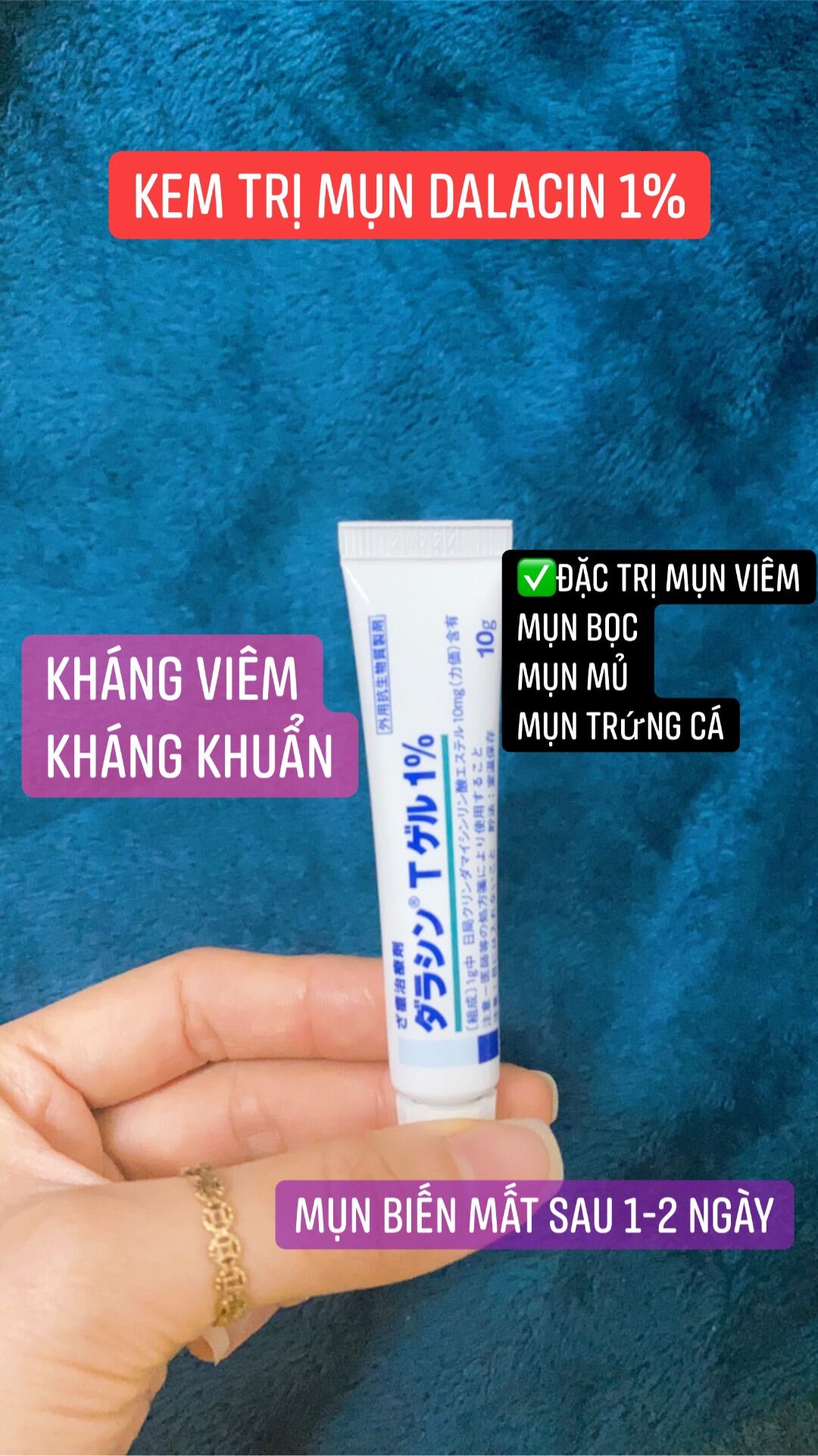 Kem Bôi Mụn Dalacin Nhật Bản