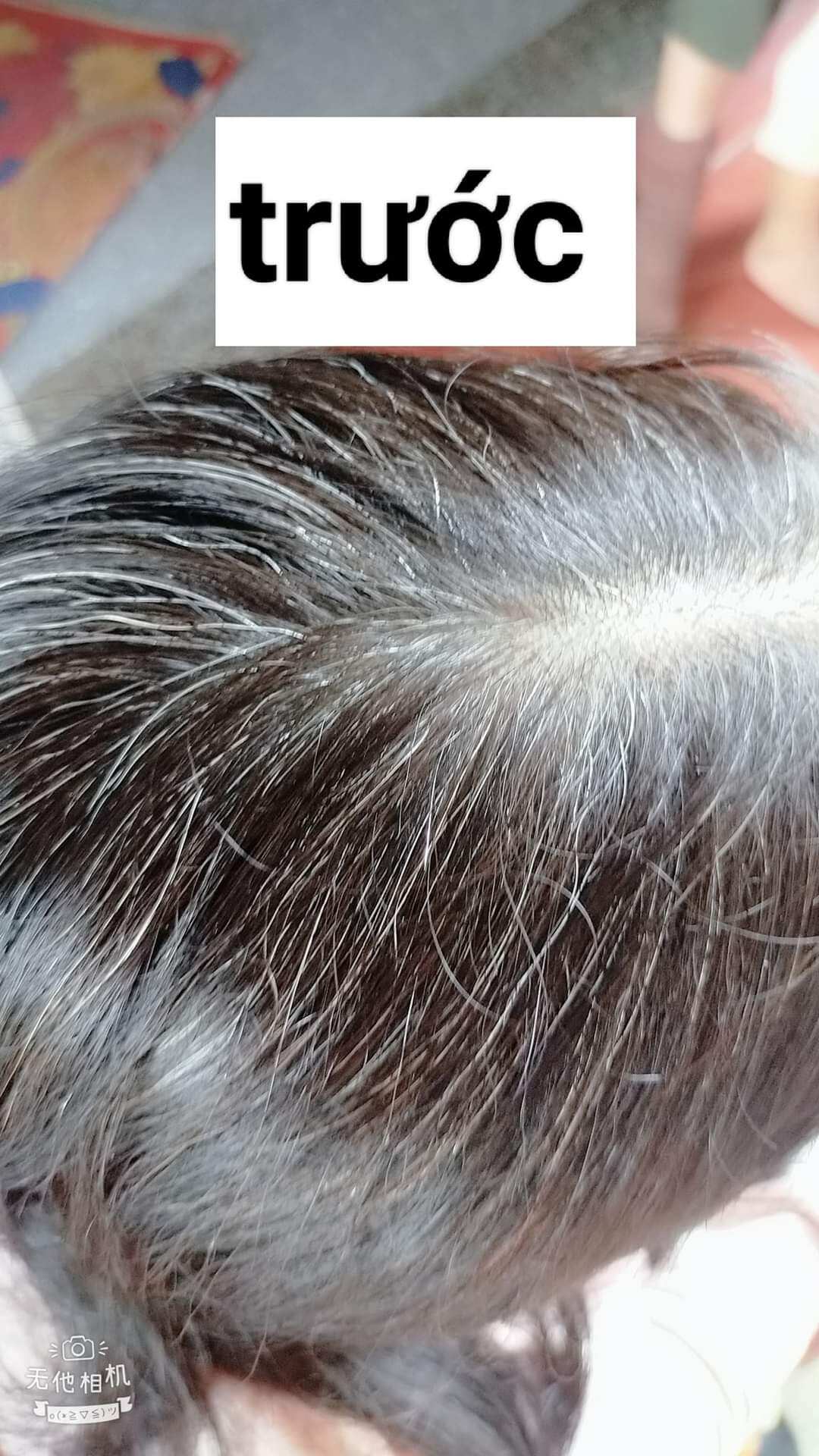dầu gội phủ bạc Trường Thọ *star Dạ Thảo Liên