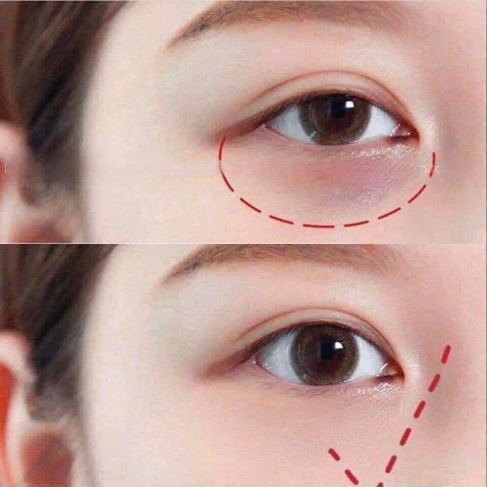 Kem mắt EL mini 5ml (date 2026)