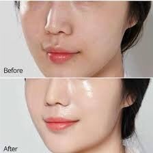 Kem Trẻ Hoá Phục Hồi Dưỡng Trắng Da