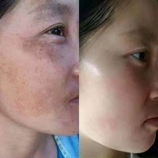 [HCM] combo chuyên nám siêu phẩm Huỳnh Đỗ