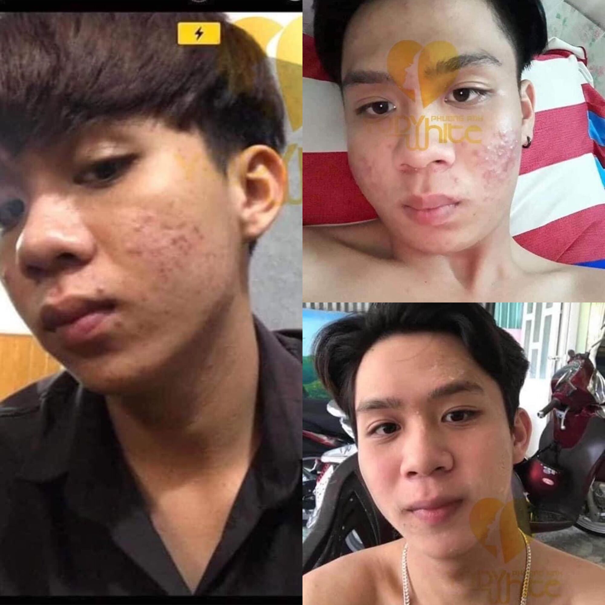 Combo ( tái tạo da - bột rửa mặt) yody giúp tái tạo da