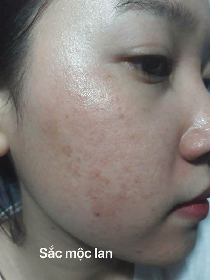 [CHÍNH HÃNG] COMBO SẮC MỘC LAN - KÈM QUÀ