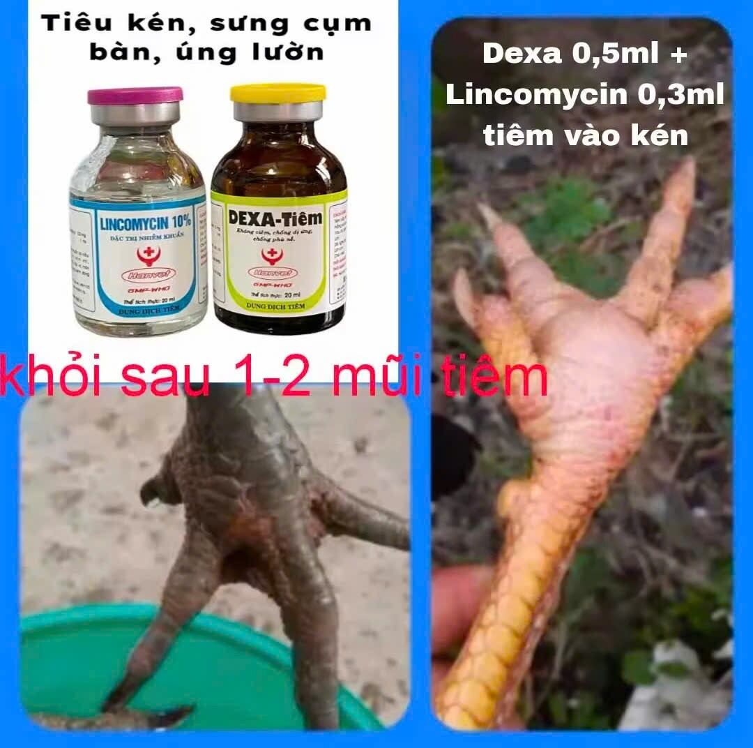 Bộ đôi Tiêu kén gà chọi, kén lườn, úng lườn, sưng củ bàn, kén đầu, sưng gối (1 lọ dexa và 1 lọ lincomycin)