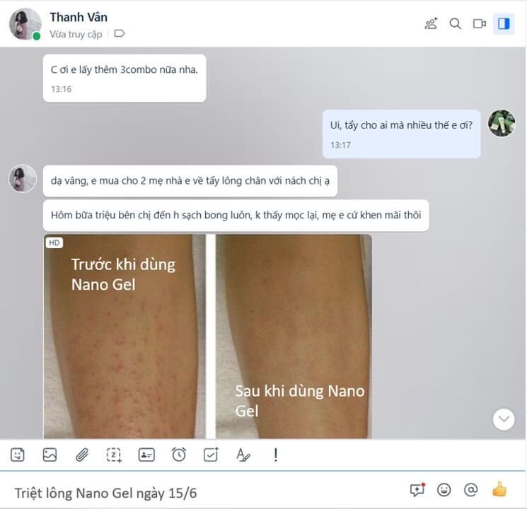 KEM TRIỆT LÔNG NANO GEL