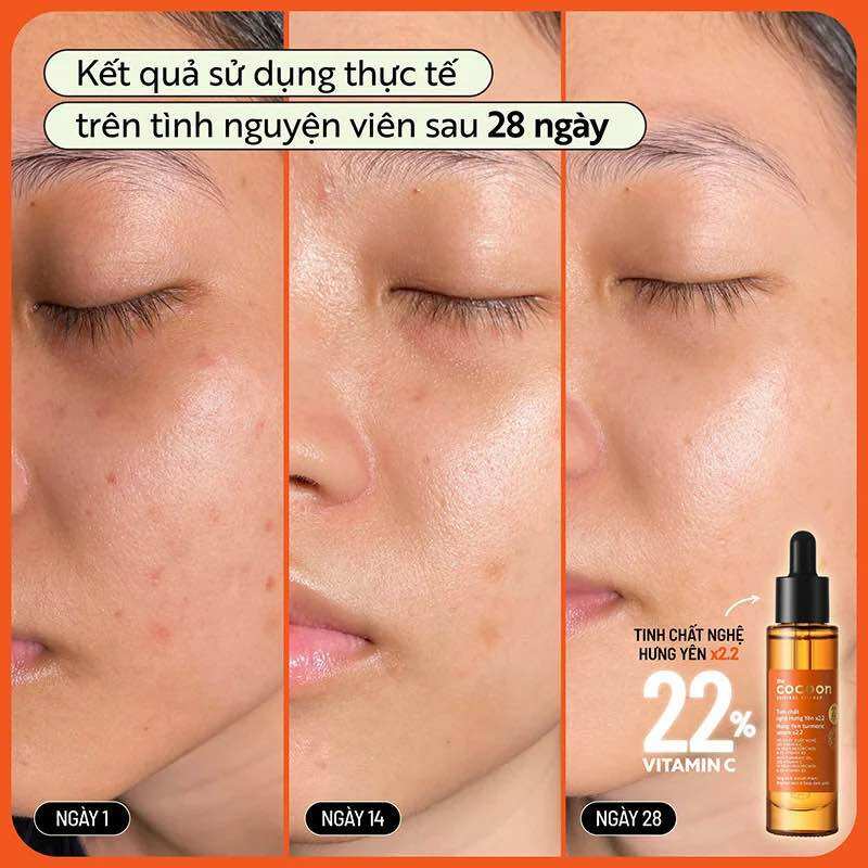 Tinh chất nghệ Hưng Yên Cocoon 22% ( 30ml)
