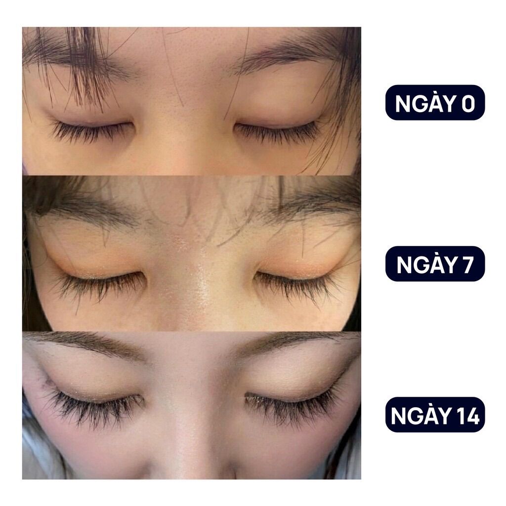 COMBO SERUM DÀI MI KÍCH MỌC MI DÀI VÀ DÀY