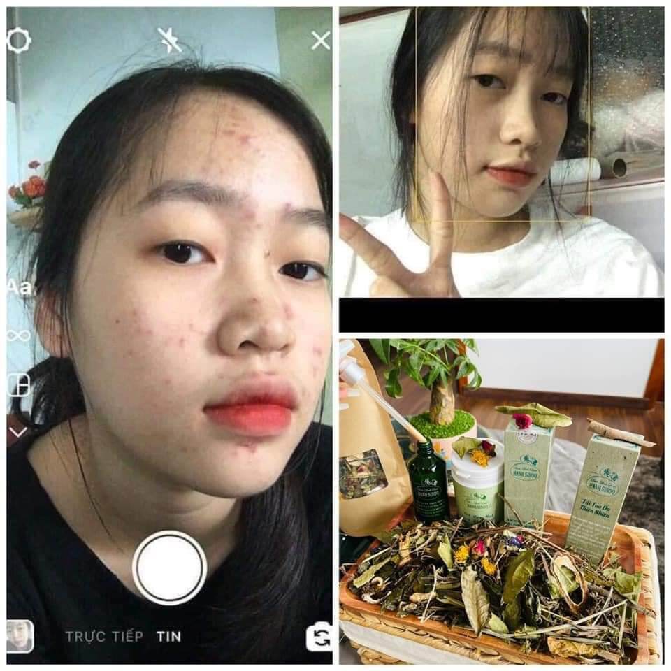 COMBOL ĐÔNG Y HẠNH SINOO