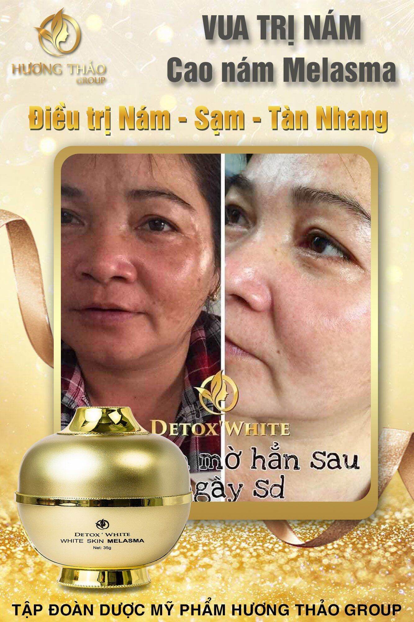 CAO NÁM MELASMA WHITE SKIN DETOX WHITE