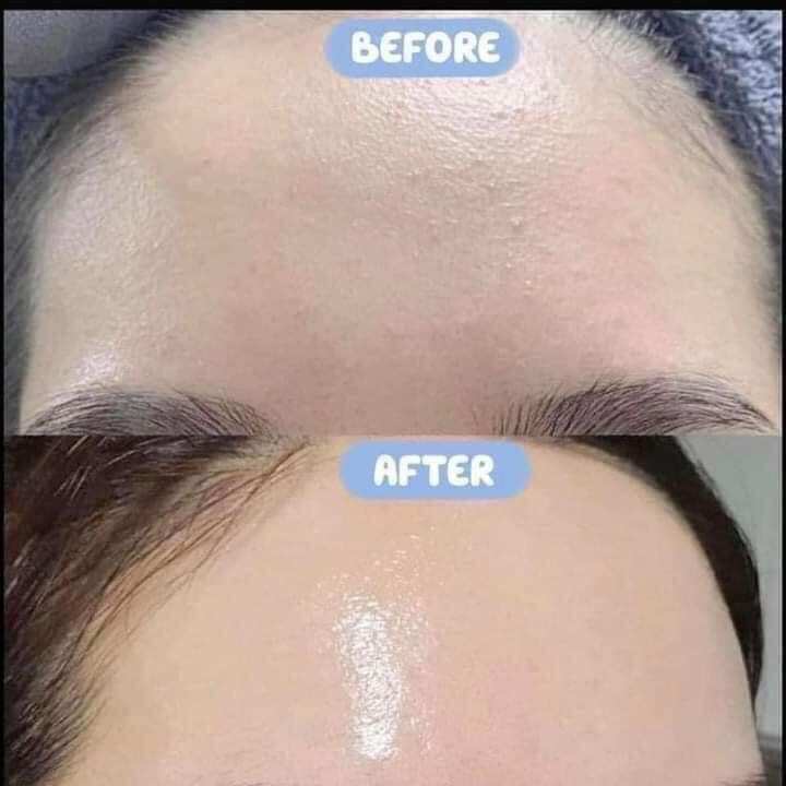 Serum HA + B5 Cấp Ẩm Phục Hồi Da SMAS 120ml