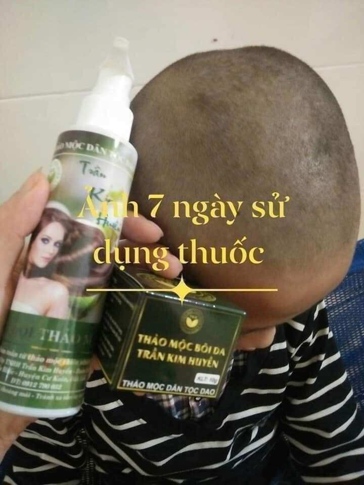 Dầu gội thảo mộc Trần Kim Huyền