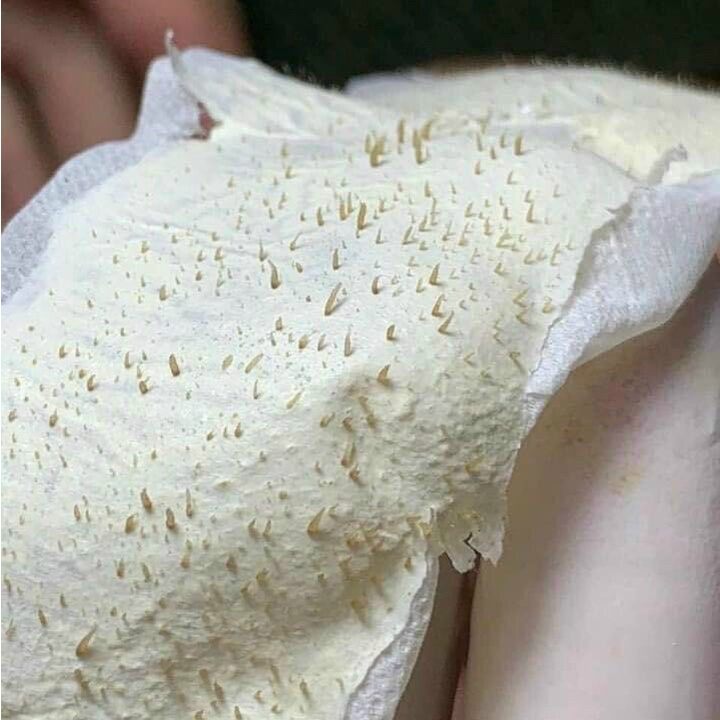 Gel lột mụn đầu đen handmade