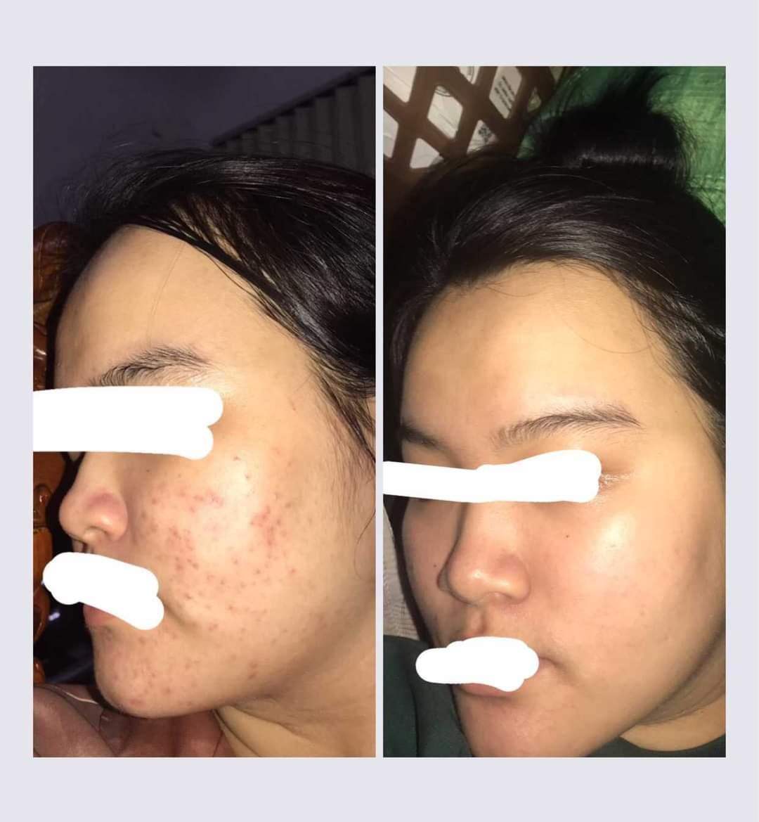 Đông y Sắc Ngọc Nữ tái tạo da