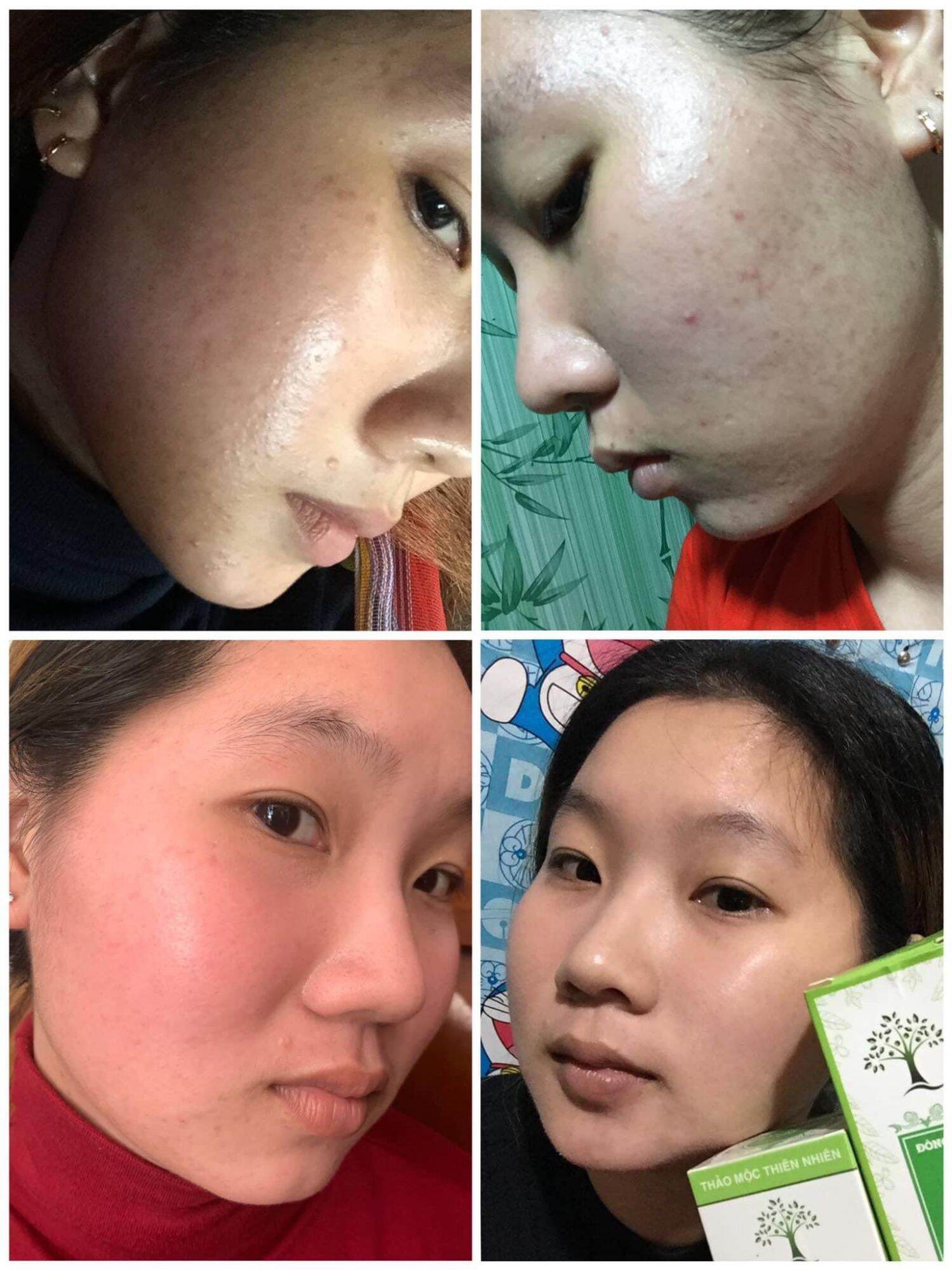 Đông y Sắc Ngọc Nữ tái tạo da