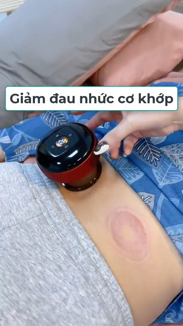 Máy giác hơi cạo gió cầm tay massage kết hợp nhiệt và áp suất âm giúp giảm đau nhức cơ, mệt mỏi, lưu thông khí huyết