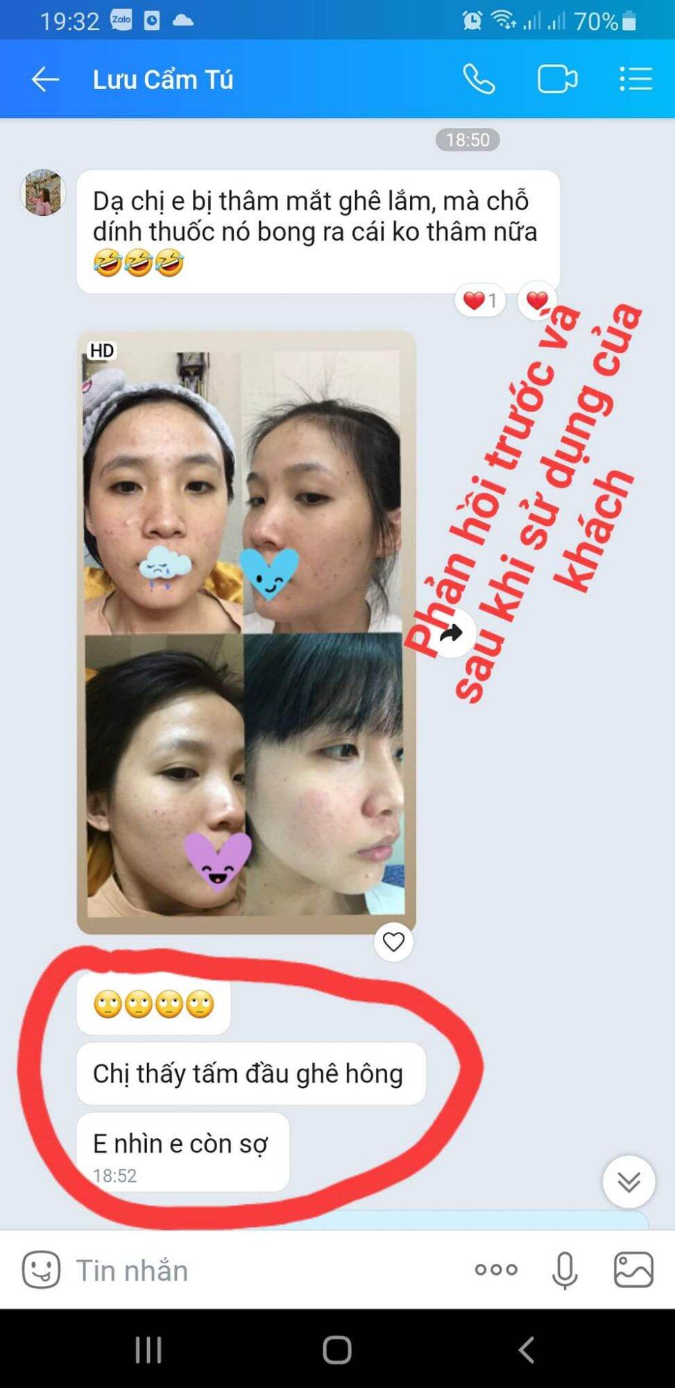 BỘ TÁI TẠO DA HỒNG SÂM NGỌC NGÂN