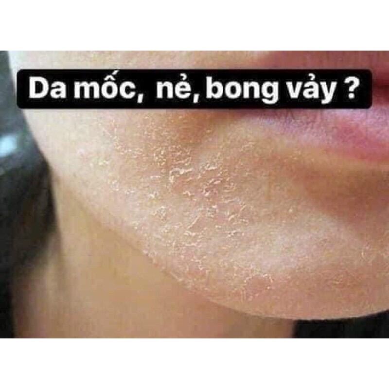 KEM NẺ VASELINE VIỆN BỎNG QUỐC GIA