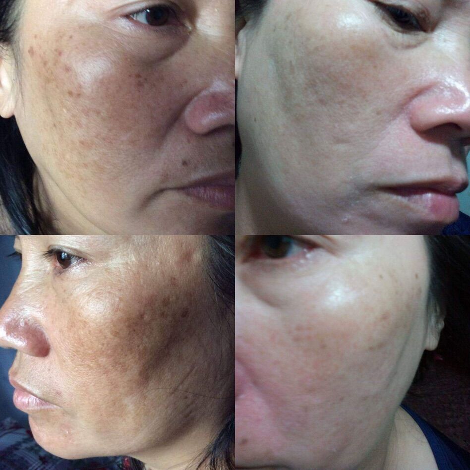 Tái Tạo Thanh Trang( Loại Cấp Tốc)