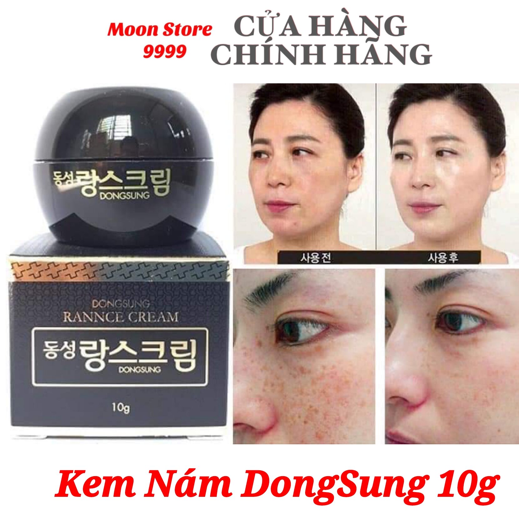 Kem giảm NÁM dưỡng trắng phục hồi da Dongsung Rannce Cream Hàn Quốc Hộp Mini 10g