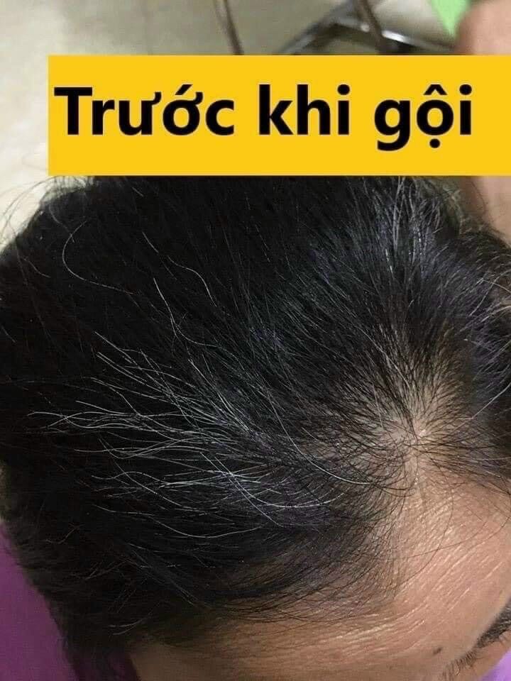 Dầu gội phủ bạc Nhân Sâm thảo dược Hàn Quốc