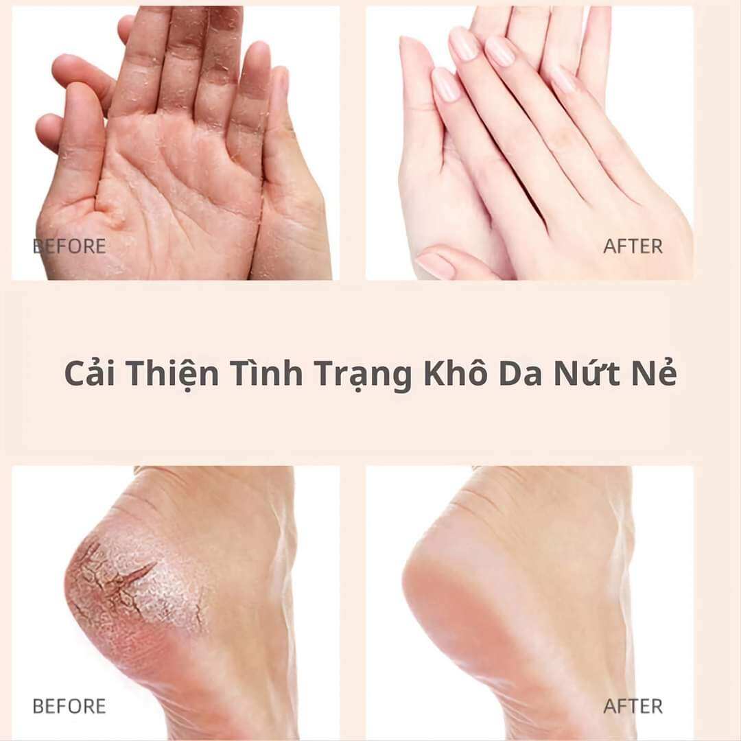 kem nứt gót chân heyxi chính hãng