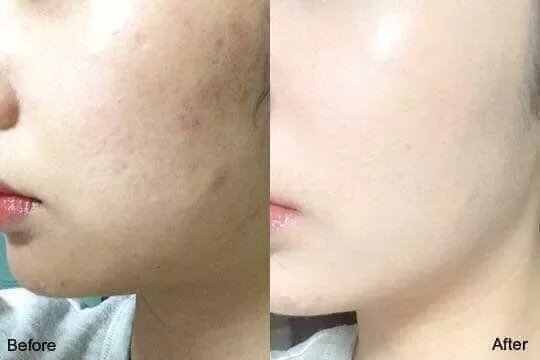 Kem Dưỡng Trắng Da Ohui Extreme White Cream 20ml
